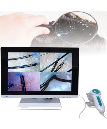 Scalp Detector Skin Diagnosis Hair Analyzer 15 Inch Screen Digital Skin Detector Moisture Tester Hair Skin Analyzer Machine for Home Beauty Salon Spa