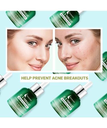 Zone 365 Brightening Serum with Vitamins C & E, Ferulic Acid, Hyaluronic Acid - Correct Skin Imperfections - Buy Online on GoSupps.com