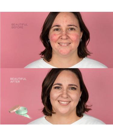  Cent Pur Cent Loose Anti-Redness Powder - Easy to use - Bye Bye redness - Buy Online on GoSupps.com