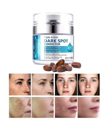 Dark Spot Remover for Face Fast-Acting Dark Spot Corrector Remover for Face and body Hyperpigmentation Fades Melasma Freckle Sun Spots Evens Skin Tone Age Spot Remover for Women Men