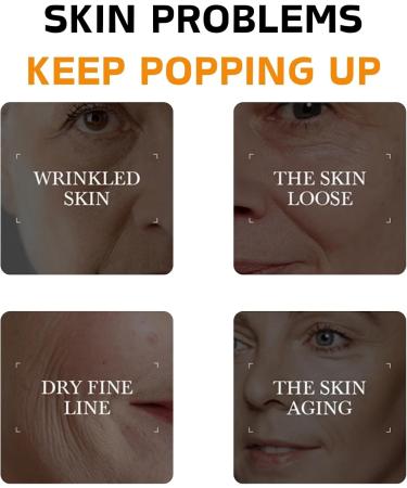Turmeric Face Cream - Face Moisturizer for Women - Face Moisturiser with Turmeric & Vitamin C - Natural Skincare Ingredient - Anti-Aging Moisturiser Face Women - Dark Spot Remover Face Cream for Women - Buy Online on GoSupps.com