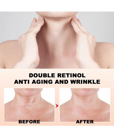 New Dual Retinol Anti-Wrinkle Neck Cream Retinol Anti-Aging Neck Cream Moisturizing Neck Cream Collagen Lifting and Firming Neck Cream Moisturizer - Buy Online on GoSupps.com