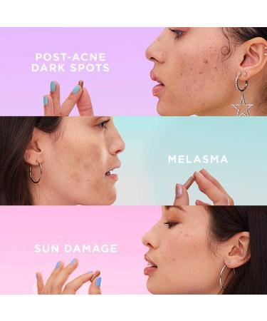 ZitSticka Blur Potion: Vitamin Supplement for Hyperpigmentation, Melasma & Dark Spots - 30 Caps - Buy Online on GoSupps.com