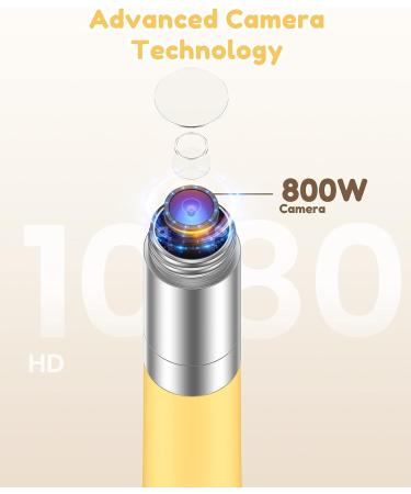Xlife Wireless Ear Wax Removal Tool with 6 LED Lights and 360-Degree Gyroscope - Kid-Friendly Ear Cleaner and Earwax Remover - Compatible with Smartphones - Buy Online on GoSupps.com