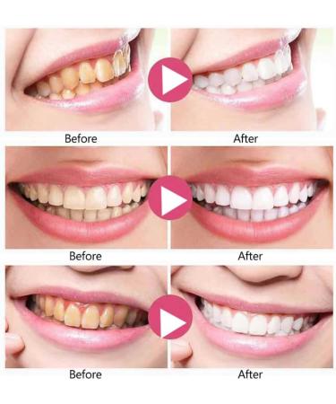 Allbestaye Foam Toothpaste Mousse - Whitening Stain Removal & Fresh Breath for a Bright Smile - Buy Online on GoSupps.com