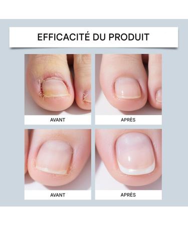  G n rique Nail Care Products - 15ml Nourishing Liquid - Nail Care Drops | For Dryness Redness Thickening Women Men Home Manicure Salon Pedicure Preparation - Buy Online on GoSupps.com