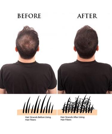 IMMETEE Keratin Hair Building Fibers Powder - Conceal Thinning Hair, Cover Hair Loss - Dark Brown - 25g/0.88oz - Buy Online on GoSupps.com