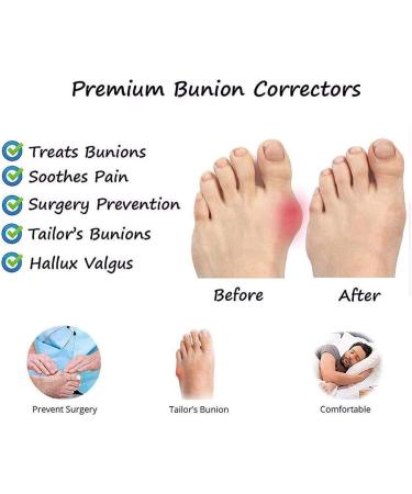 Women's Summer Slip-On Bunion Sandals | Open Toe Contrast Color Fish Mouth Slippers for Beach & Pool - Hallux Valgus Comfort 6.5 Gris - Buy Online on GoSupps.com