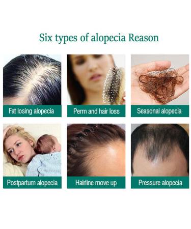 Hair Growth Serum - Thicker Longer Fuller Hair | Prevent Hair Loss & Thinning | Vitamin-Rich Natural Treatment - Shop Now - Buy Online on GoSupps.com
