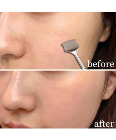 3 Blackhead Extractor Tool | Pimple Cleaning Tool Comedone Pimple Extractor Tool for Blackhead Whitehead Popping Zit Removing Nicything 3 Pcs a - Buy Online on GoSupps.com