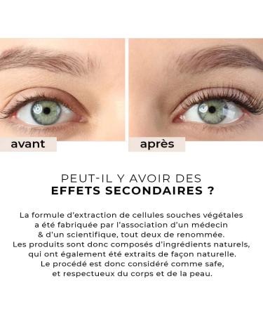 NuoCell | Eyelash Serum with Plant Stem Cells | Growth Booster for Thicker Darker and Longer Eyelashes | Eyelash Growth Facial Treatment | Organic & Vegan Formula | 8 ml - Buy Online on GoSupps.com