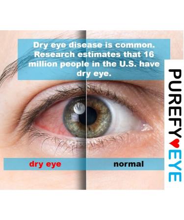 PUREFYEYE Hypochlorous Eyelid Cleanser - 1.7oz | Dry Eye Relief Skin Irritations Rosacea & Pink Eye Care | Gentle Non-Irritating & Hypoallergenic - Buy Online on GoSupps.com