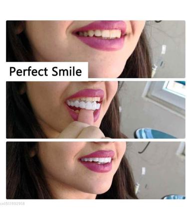 Xiaocui Instant Veneers Teeth - Comfortable Upper & Lower Dentures for a Perfect Smile | 2-Piece Set - Buy Online on GoSupps.com