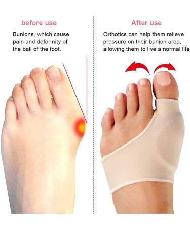 LYITZW Hallux Valgus Correction Splint - 2 Pieces with Silicone Shock Absorber & Toe Splitter for Pain Relief - Buy Online on GoSupps.com