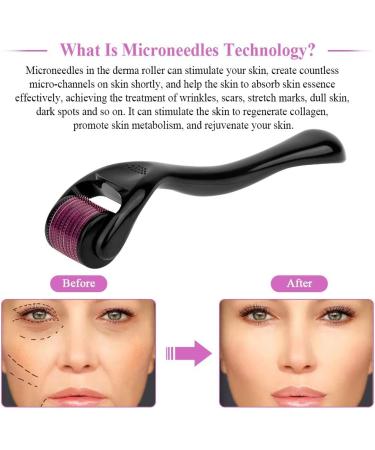 Derma Roller 1.5mm for Face Body Skin Care Microneedle 540 Dermarolling Beard Hair Regrowth Stainless Steel Needle for Wrinkle Stretch Marks Scar Cellulite Women Men - Buy Online on GoSupps.com