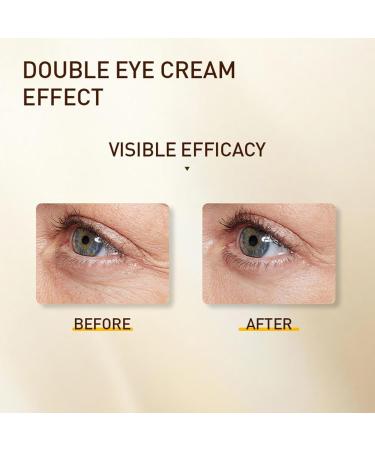 Eye Cream with Advanced Retinol + Peptides + Caffeine for Puffy Eyes and Dark Circles Wrinkles Anti Aging Under Eye Bags Treatment Instant Tightener Fragrance Free (1*set) - Buy Online on GoSupps.com