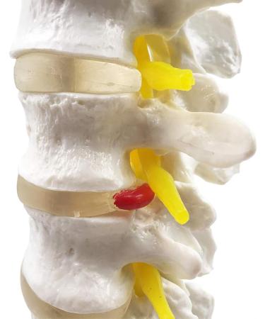 Human Spine Model - 1:1 Life Size Life Size Lumbar Spine Anatomical Model Lumbar Spine Model with Sacrum and Spinal Nerves for Osteopath Office and Student Study - Buy Online on GoSupps.com