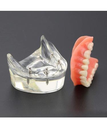 ESBANT Anatomy Teeth Model | Dental Study & Teaching Aid for Home Care - Buy Online on GoSupps.com