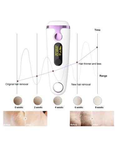 Crystal Hair Eraser for Women and Men - Painless Magic Hair Remover for Arms, Legs, and Back - Buy Online on GoSupps.com
