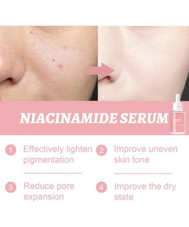 Peach 70 Niacin Serum 70% Peach Niacinamide Serum Dark Spot Correcting Glow Serum Hydrating Face Serum for smoother & glower Skin Texture in Spot-prone Skin Face Serum for Women For Dull Tired Skin - Buy Online on GoSupps.com