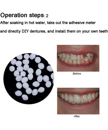 Flipped Warm False Teeth Veneers - 2 Pairs Cosmetic Temporary Dentures for a Perfect Smile - Buy Online on GoSupps.com