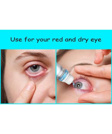 Bepanthen Eye Drops - Relief for Dry Burning Itchy & Red Eyes | Fast International Shipping - Buy Online on GoSupps.com