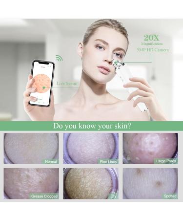 FDA Certified Blackhead Remover Pore Vacuum with WiFi Camera and 6 Suction Heads - Electric Facial Cleanser for Pimple Acne Extraction - White - Buy Online on GoSupps.com