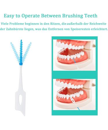 Interdental Brushes - 20-Piece Tooth Cleaning Set for Gaps | Blue Dental Brushes for Optimal Oral Care - Buy Online on GoSupps.com