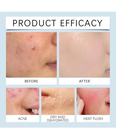 Hyaluronic Acid Microneedling Serum Hyaluronic Acid Serum Gla-Mory Micro-Infusion Facial System Hyaluronic Acid Micro Needling Roller Hyaluronic Acid Face Serum for Women Hydrating Anti Wrinkle - Buy Online on GoSupps.com