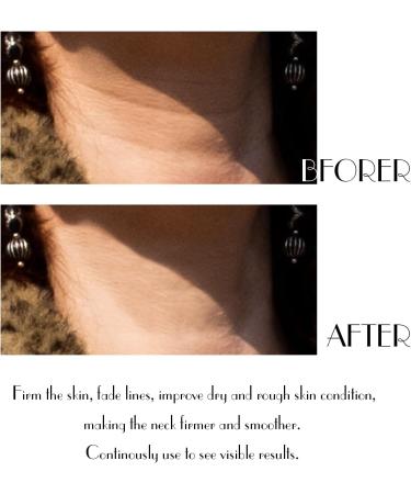 IMIM Neck Firming Cream Double Chin Reducer that Works Anti Wrinkle Cream Skin Tightening Cream Really Works for Sagging Skin Anti Ageing 50ml white Classic - Buy Online on GoSupps.com