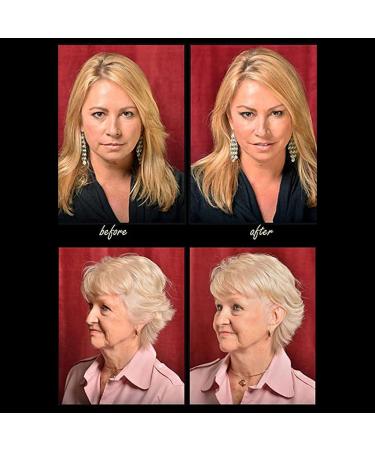 Buy Reusable Facelift Bands with Clips | Instant Invisible Hairpin for Face Slimming - Portable & Discreet (Beige) | International Shipping Available - Buy Online on GoSupps.com