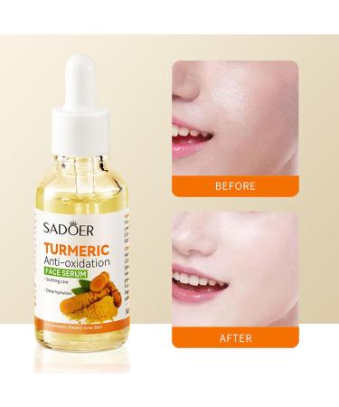 Turmeric Moisturizer Serum - Hydrating Face & Body Skincare for All Skin Types | Deep Moisturizing for Dry Skin - Buy Online on GoSupps.com
