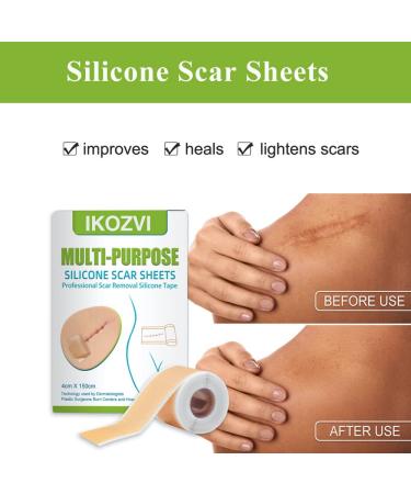 Silicone Scar Sheets 1.6 x 60 - Keloid & Burn Scar Removal Tape - Buy Online on GoSupps.com