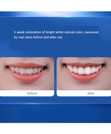 Manmaning Probiotic Tooth Powder - Remove Tooth Stains & Freshen Breath (1 Piece Blue) - Brighten Your Smile - Buy Online on GoSupps.com