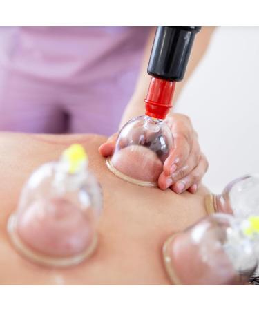 Buy Sifa 50x Cupping Glasses & Pump - Hijama Cupping Cups (6cm) for Holistic Health - International Shipping Available - Buy Online on GoSupps.com