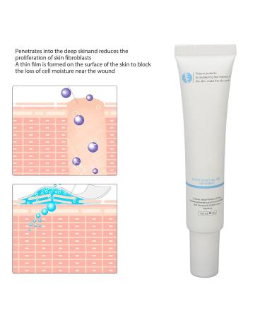 Scar Removal Ointment Gel - Herbal Cream for Old & New Scars, Stretch Marks, Surgery Injuries, Burns & Acne Treatment 1.1oz - Buy Online on GoSupps.com