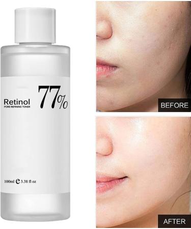 77% Soothing Toner for Face Facial Toner Soothing Toner for Deep Hydration Skin Care Skin Refreshing Essence to Even Skin Tone Deep Calming Soothing Serums Moisturizing Refreshing and Even Skin Tone - Buy Online on GoSupps.com