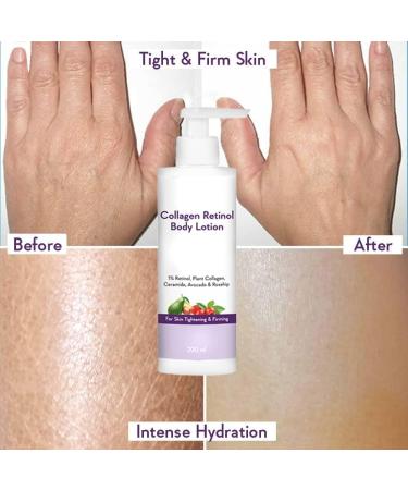 MI Collagen 1% Retinol Body Lotion - for Skin Tightening & Firming - with Niacinamide Ceramide Rosehip & Avocado - for Men & Women - 200 Ml - Buy Online on GoSupps.com