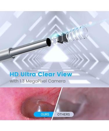 Anykit Ear Wax Removal Tool HD Otoscope for Android and PC - Ultra Clear View Ear Camera with LED Lights and Wax Remover - 3 Pack Ear Spoon Sets - Buy Online on GoSupps.com