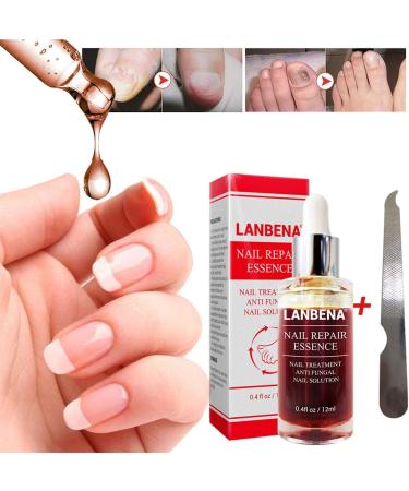Beito 1PC Nail Repairs Solution de renouvellement des ongles l'huile essentielle tue les ongles fongiques Traitement fongique pour ongles cassants et craquel s (12ML) - Buy Online on GoSupps.com