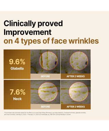 ISOI Intensive Lifting Gua Sha Ampoule Stick Eye Roller Under Eye Serum for Dark Circles Puffy Bags and Wrinkles with Bulgarian Rose Oil & Peptide Complex Korean Skin Care (0.5 fl.oz 15ml) 0.5 Fl Oz (Pack of 1) - Buy Online on GoSupps.com