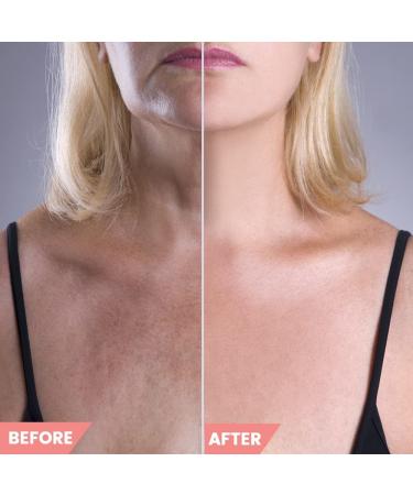 Chest Wrinkle Pads Set - Silicone Decollete & Neck Pads for Anti-Aging Treatment - Reusable Wrinkle Patches - Transparent - 3 Pack - Buy Online on GoSupps.com