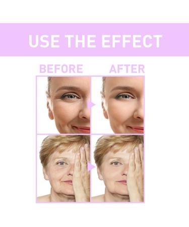 Dajidafu Women Face Wrinkle Removal Ladies Moisturizing Firming Tightening Anti-wrinkle Essence Anti-age Stock Solution - Buy Online on GoSupps.com