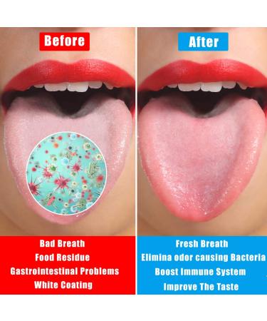 Stainless Steel Tongue Scraper - 2 Pack Oral Care Cleaner for Fresh Breath - Surgical Grade Metal for Adults & Kids - Includes Travel Cases - Buy Online on GoSupps.com