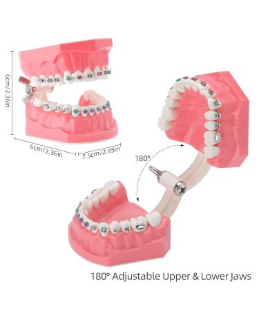 Buy Dental Demonstration Orthodontic Model with Metal Wires & Bracket - Ideal for Teaching Brushing & Flossing Practices - Buy Online on GoSupps.com