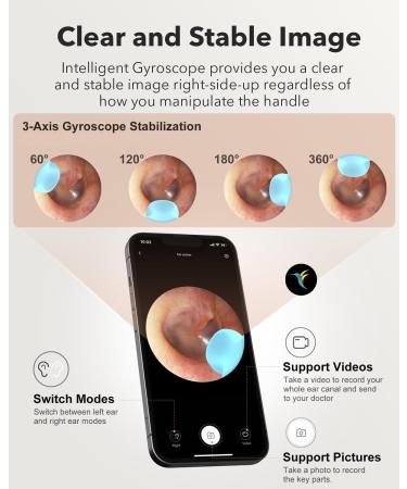 Bebird M9 Ear Wax Removal Tool - Wireless Ear Cleaner with Camera & Light | Visual Otoscope for Family | Photos & Videos | 10 Scoops & Attachments - Buy Online on GoSupps.com