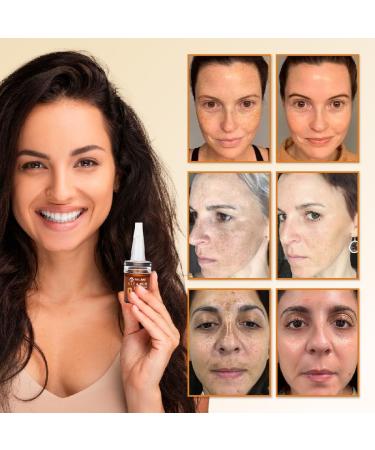 Belani Vitamin C Serum Helps Reduce the Appearance of Dark Spots & Fine Lines 1.01 Fl Oz - Buy Online on GoSupps.com
