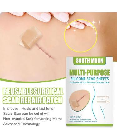 Silicone Scar Gel Strip - Efficient Scar Treatment for Surgery, Acne & Trauma - 4 * 150cm - Buy Online on GoSupps.com