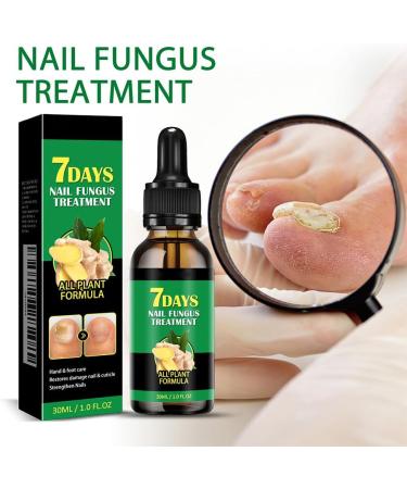  Cymwer Ginger Nail Serum 30ml Natural Growth Oil Strengthener for Fortified Nails Moisturizing and Revitalizing Care - Buy Online on GoSupps.com