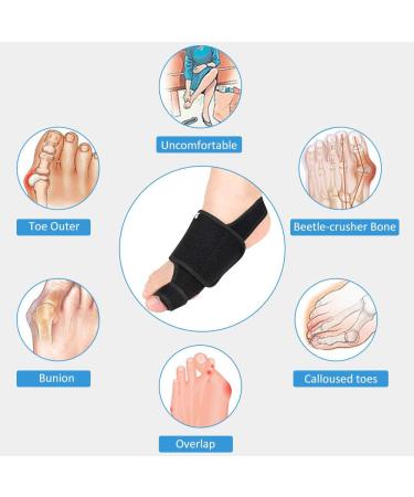 DOACT Bunion Corrector Set for Women - Toe Separator for Bunion Pain Relief - Orthopedic Bunion Splint with Gel Arch Support - Non-Surgical Hallux Valgus Correction - Buy Online on GoSupps.com